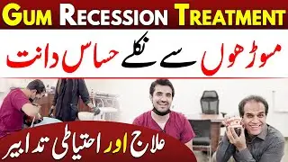 Gum Recession Aur Sensitive Teeth Ka Ilaj | Healthy LifeStyle by Shahzad Basra
