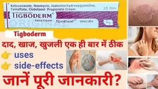 TIGBODERM Cream ki Puri jankari ।। Dad,khaj ,khujli me labhdayak.