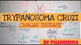 CHAGAS DISEASE || TRYPANOSOMA CRUZI || STRUCTURE || LIFE CYCLE || SYMPTOMS || BY PHANINDRA GUPTHA