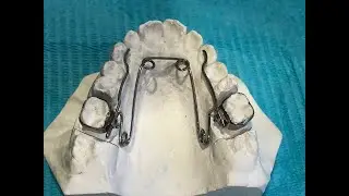 Confección de Quad Helix