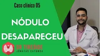 Nódulo que desapareceu - Caso clínico #05# | Dr Jônatas Catunda
