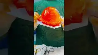 G&ouml;ğ&uuml;s B&uuml;y&uuml;tme Ameliyatı,