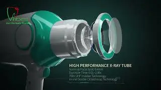 Handheld X-Ray &ndash; Efficient, and Safe Imaging Solution