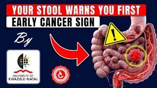 After 60, These Stool Signs Could Save Seniors from Colon Cancer