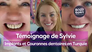 DENTISTE EN TURQUIE  | 🦷 Témoignage de Sylvie : 3 implants + 28 couronnes Emax | BODYEXPERT