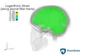 Finite element analysis to investigate axonal injury.