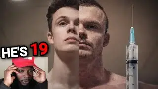 Steroids Are Making These Kids Age Like Milk..