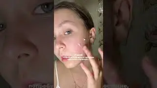 Лучшая мазь от постакне