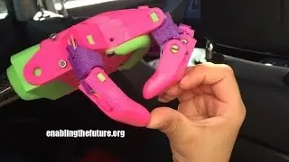 Maxence, six ans, va recevoir une main imprimée en 3D, une première en France