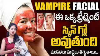 Vampire Facial | Glowing Skin | Benefits Of VAMPIRE FACIAL Treatment in Telugu | SumanTv