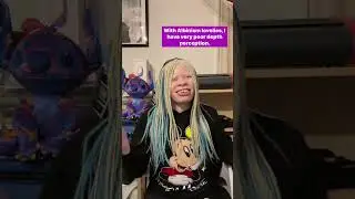 How Does A Blind Person Pour A Drink?🤔💭 Pt1 #Blind #Albinism