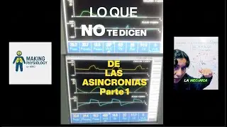 ¿CÓMO DEBE EVALUAR UN PACIENTE EN VENTILADOR MECÁNICO CON ASINCRONIAS?: LO QUE NO TE DICEN...
