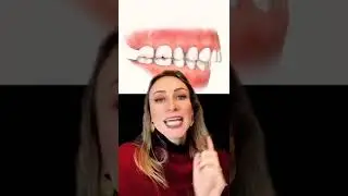 Seus dentes s&atilde;o &ldquo;pra frente&rdquo;&hellip;.Voc&ecirc; encarava isso?😰😅🫣 #aparelhoortod&ocirc;ntico