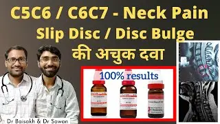 Homeopathic medicine for Migraine Headache - माइग्रेन की होम्योपैथिक दवा / headache / सिरदर्द
