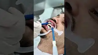 Get Your Dream Smile in Turkey | Affordable Dental Treatments with VIP Service 🦷