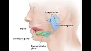 parotid cases, case based review