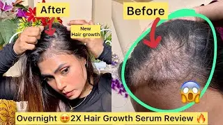 Pilgrim Hair Growth Serum 4 Months Using |Viral Hair Growth Serum & Results Wear Shocking | Samrin