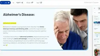 Alzheimer's disease presentation// how food effects ours brain 