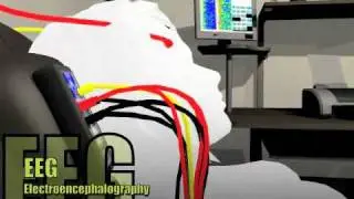 The Evolutionary Brain, Intro to Brainwave Optimization