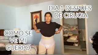 DIA 1 DESPUES DE CIRUGIA | COMO SE VE MI CUERPO|1 DAY POST OP| HOW MY BODY IS CHANGING AFTER SURGERY