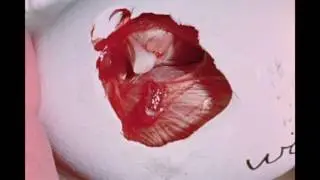 35. Experiments on the Chick Embryo: Grafting Limb Buds
