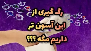 آموزش وصل اسکالپ وین به پشت دست /رگ گیری حرفه ای