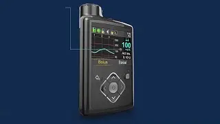 Popular insulin pump recalled amid dosage errors