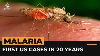 Malaria contracted in United States for first time in 20 years | Al Jazeera Newsfeed