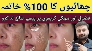 100% remove pigmentation || best cream for pigmentation and malasma