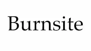 How to Pronounce Burnsite