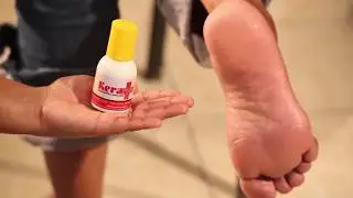 KeraPlus, peeling para pies resecos.