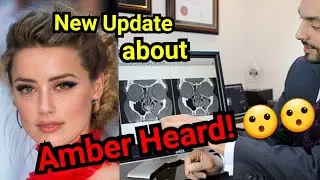 Most Scientific Beautiful Face in the World Amber Heard Face | SciPedia - ENGLISH