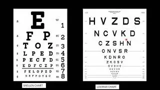 LogMar/ ETDRS CHART calculation.