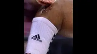 Kevin Ware Breaks His Leg. Video may not be suitable for young viewers.