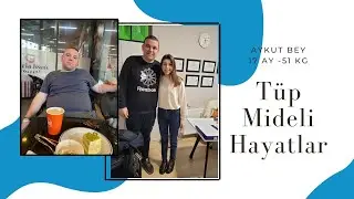 Op. Dr. Onur Kesler - Tüp Mide Ameliyatı Tekirdağ - Çorlu #obezitecerrahisi #tüpmideameliyatı