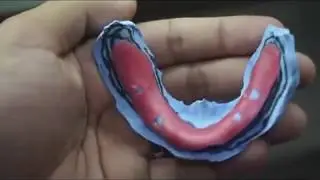 pembuatan sendok cetak individual tray