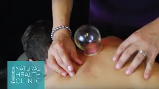 Acupuncture: Cupping Therapy