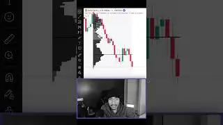 Gold Trap Trading 🪤