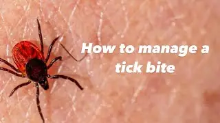 Tick bites