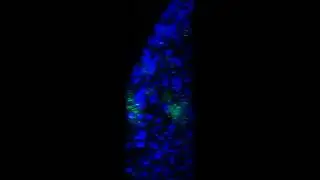 LNCap (Lymph Node Cancer Prostate) cells - 5 days in sodium alginate and cellulose