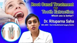 Root Canal vs. Tooth Extraction: Making Informed Dental Decisions with Dr. Rituparna Saha