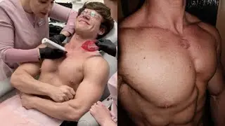ZOSTAŁEM PO$TRZELONY! (historia mojej blizny)/ Natan Marcoń