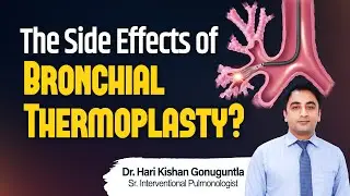 Bronchial Thermoplasty: Procedure, Side Effects | Asthma Test | Cleaning Airways | Hi9