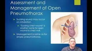 AEMT Chest Injury Emergencies Part 2