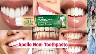 Apollo Noni Toothpaste Review
