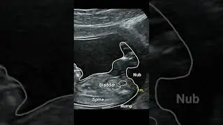 Объяснение теории Nub: название приложения Gender Reveal (nubx)