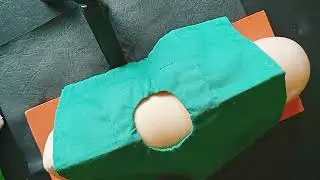 Praktek Pemasangan & Pencabutan KB Implan