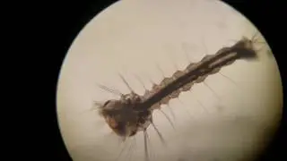 Mosquito Larvae Under Microscope