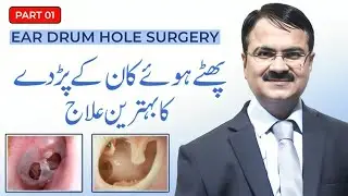 Ear Drum Hole Surgery | Best Treatment for Perforated Eardrum (Part 1) | Dr Tariq Ali Shaikh
