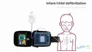 Philips HeartStart FRx AED कसा वापरावा | Rugged AED Training